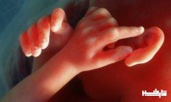 محافظت از نوزادان پیش از تولد با فناوری «جفت روی یک تراشه»