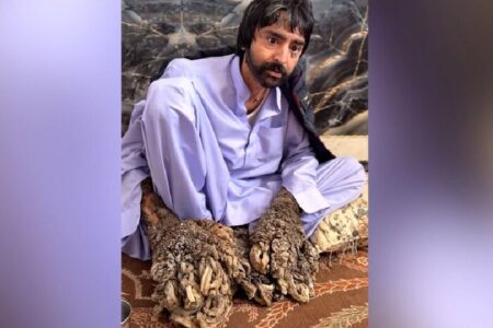 بیماری‌های نادر و رنج‌های وافر